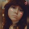scar_baby